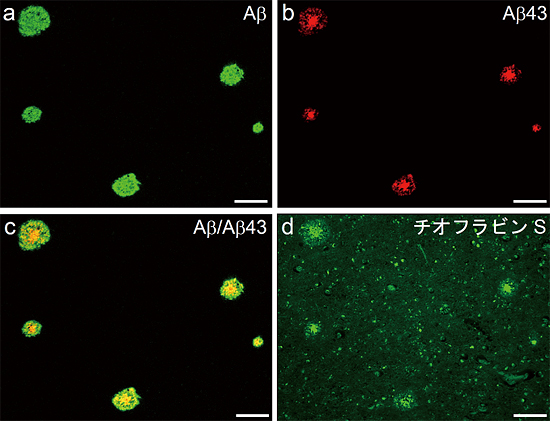 アルツハイマー病患者のアミロイド斑におけるAβ43の局在の図