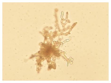 重イオンビームを照射して3カ月後のマコンブの配偶体の図