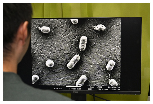 細菌膜小胞がつくられる様子を観察するの写真