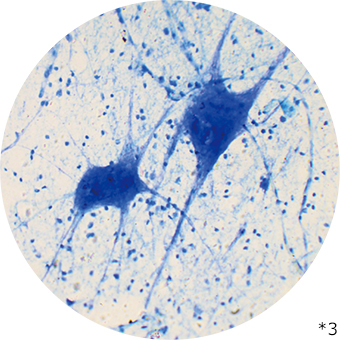 神経細胞の写真