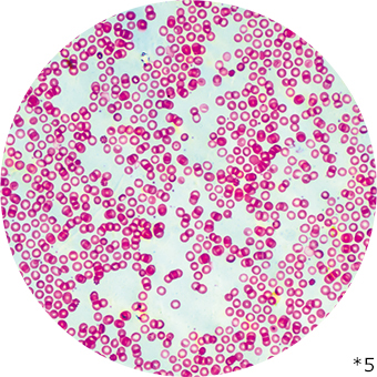 血液の細胞の写真