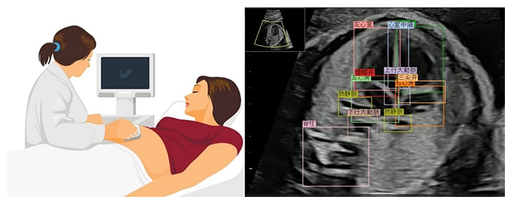 胎児心臓超音波スクリーニング支援システムの図