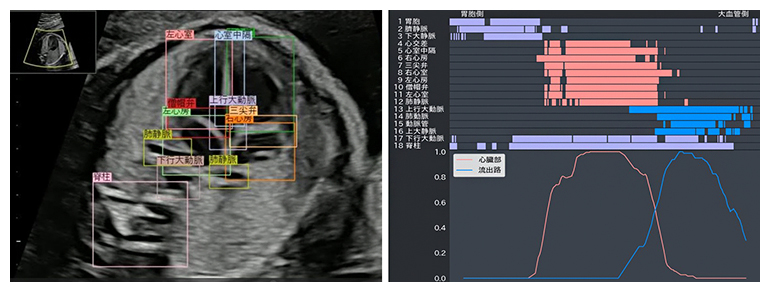 バーコードと検出率グラフの図