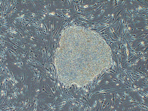 Photograph of iPS cells