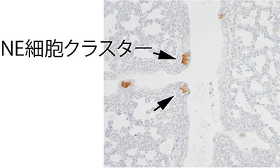 マウス胎児のNE細胞を染色した画像の図