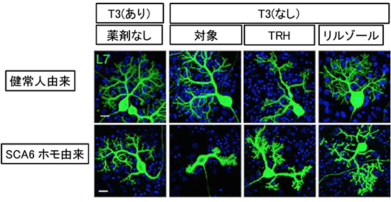 甲状腺ホルモンT3の有無によるプルキンエ細胞の形態変化の図
