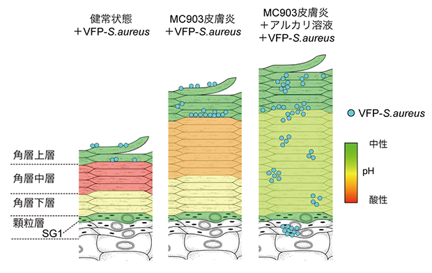 角層中層は黄色ブドウ球菌侵入を阻止するバリアの図