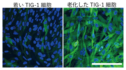 細胞老化によるTIG-1細胞の硬化の図