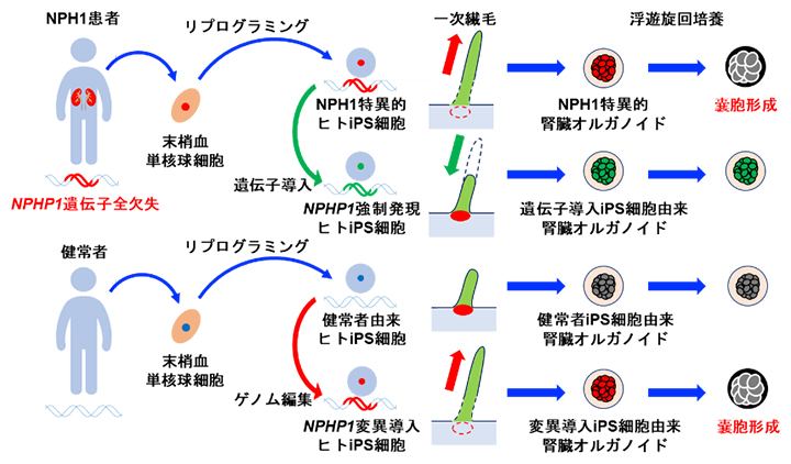 若年性ネフロン癆の病態モデリングの概要の図