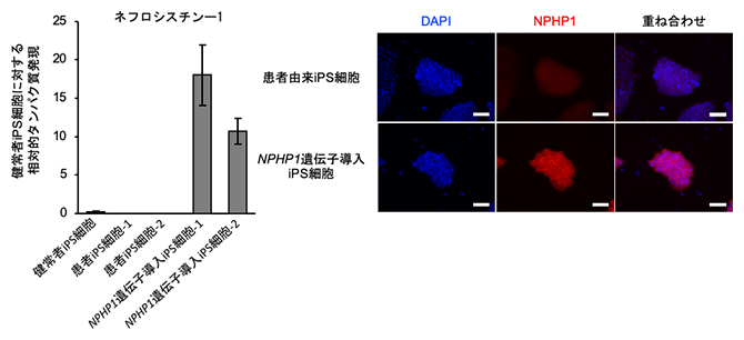 患者由来iPS細胞からのNPHP1遺伝子強制発現の図