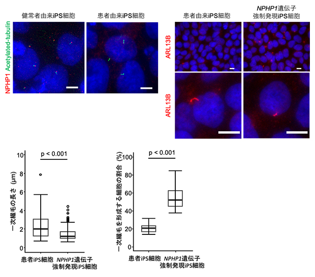 ヒトiPS細胞における一次繊毛の形態に関する比較解析の図