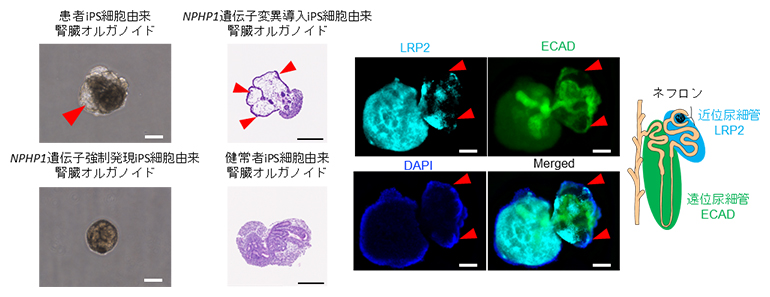 浮遊旋回培養による疾患特異的な腎嚢胞形成の図