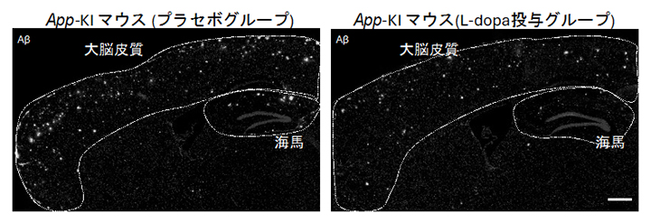 L-dopaの長期投与によるAβ蓄積量の低減の図