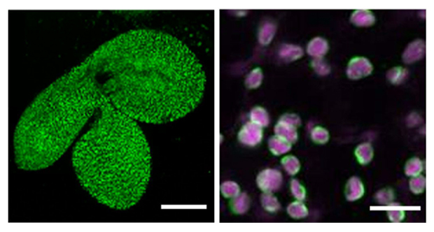 種子の胚で発現する酵素LPAT1と葉緑体の表層近くにあるLPAT1の図