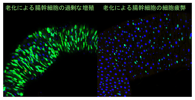 老化時に起こる腸幹細胞の過剰な増殖（緑）と、増殖しない疲弊した腸幹細胞（青）の図