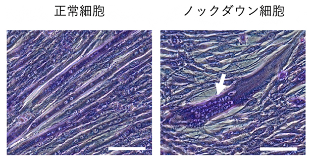 正常細胞には見られないノックダウン細胞中の核の凝集の図