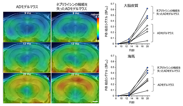 ネプリライシン活性低下によるPiBシグナルの増強の図