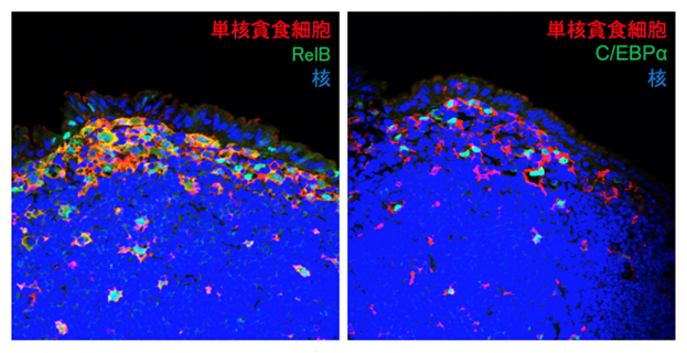 パイエル板における転写因子RelBとC/EBPα発現様式の図