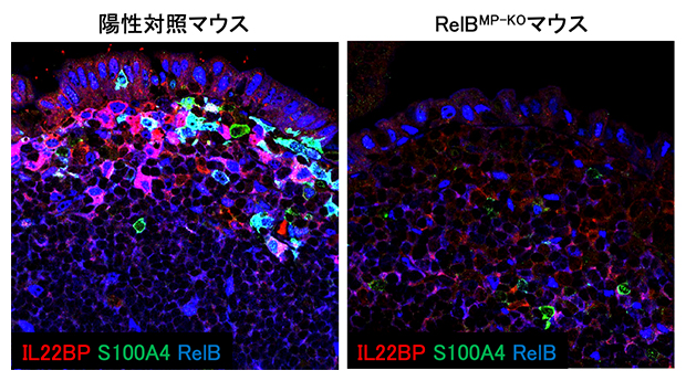 転写因子RelBのIl-22BPとS100A4の発現制御の図