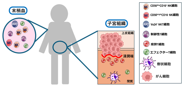 子宮頸がんにおける末梢血と腫瘍免疫微小環境の乖離の図