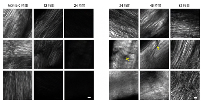 冷凍熟成過程におけるマグロ切り身のSHG画像の図