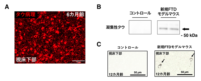 新規前頭側頭型認知症モデルマウスに見られるタウ病理の図