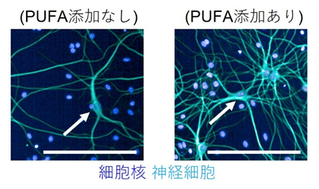 神経突起の評価の図