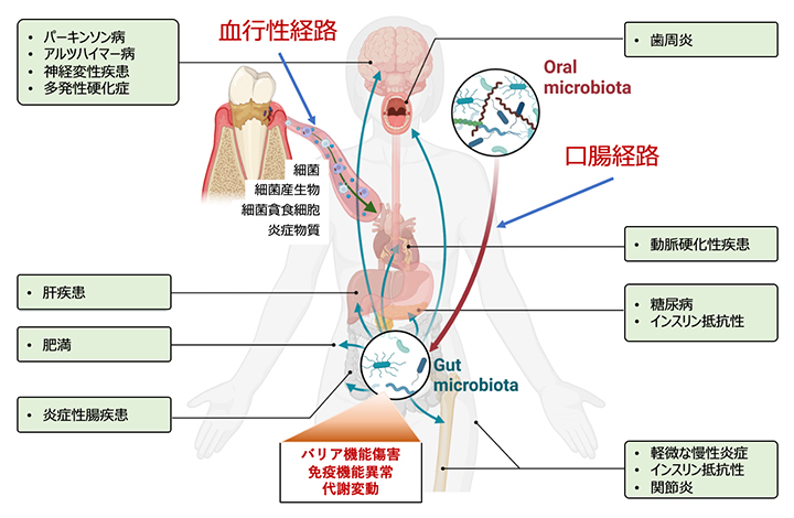 歯周病が全身疾患に影響を与える因果メカニズムの図