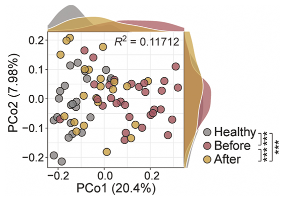 歯周病患者と健康な人の唾液細菌叢の違いの図