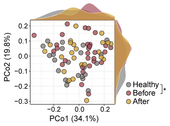 歯周病患者と健康な人の腸内細菌叢の違いの図