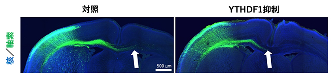 YTHDFの発現抑制による軸索の短縮の図