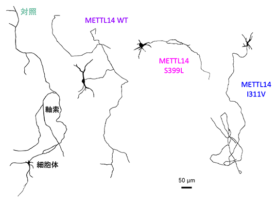 変異METTL14の導入による軸索の異常の図