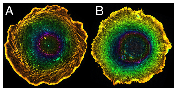 超解像顕微鏡法（拡張顕微鏡法）を用いたアクチン繊維の局在解析の図