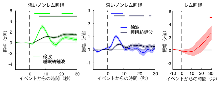 睡眠中の脳波活動に対応して生じる脳脊髄液（CSF）信号の変化の図