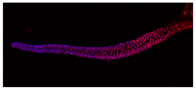 イントロン・ヒッチハイクにより線虫の生殖細胞で発現するテロメレースRNAの図