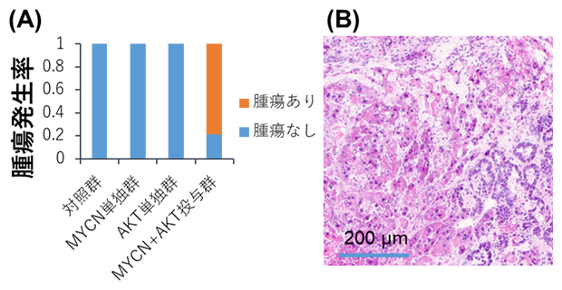 MYCN過剰発現による肝発がんへの促進の図