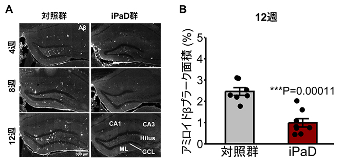 iPaDによるアミロイドβの蓄積抑制の図