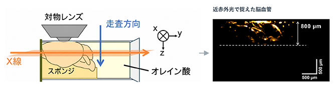 NIR-MAXWELLの観察原理と脳血管画像の図