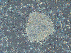Microscopic image of an iPS cell