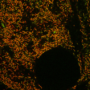 Image of endosymbiotic spirochetes