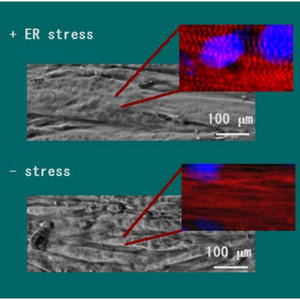 Image of muscles with and without ER stress
