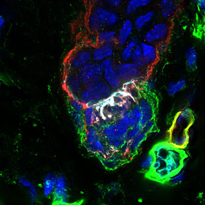 microscopic image of basement membrain