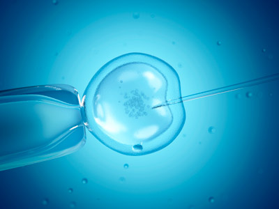 image of in vitro fertilization