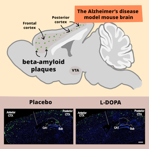 illustration of Alzheimer's disease mouse brain