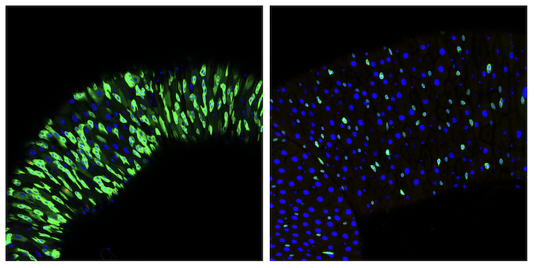 images of fly gut stem cells in different status