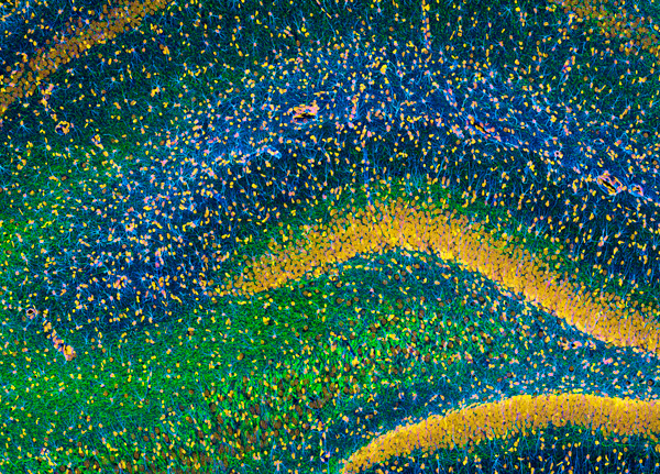 microscopic image of the hippocampus of a rat’s brain