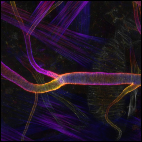 image of actin fibers
