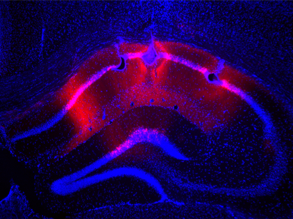 microscopic image of a hippocampus