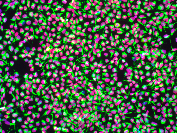 microscopic image of neural stem cells