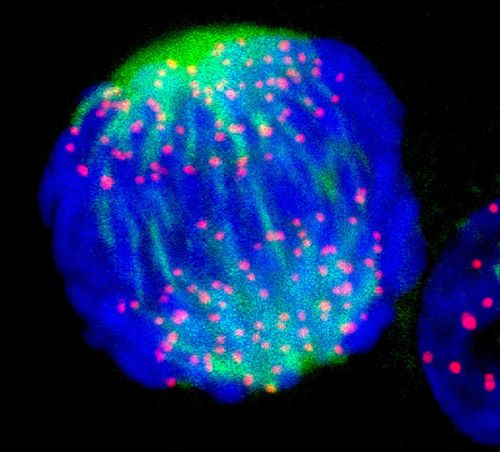 image of a breast cancer cell